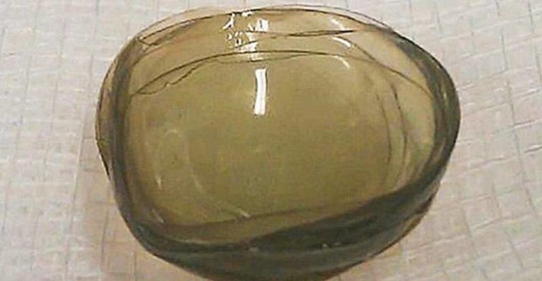 Lenti