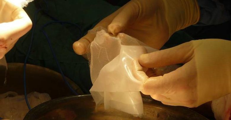 Pelle artificiale