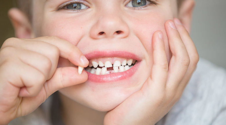 denti da latte