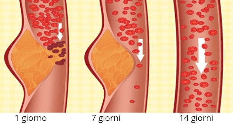 2000 dieta calorica per gli uomini