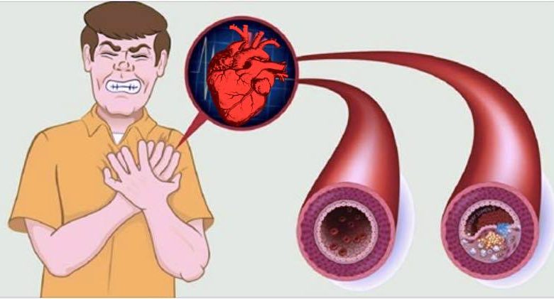 alimenti che proteggono il cuore