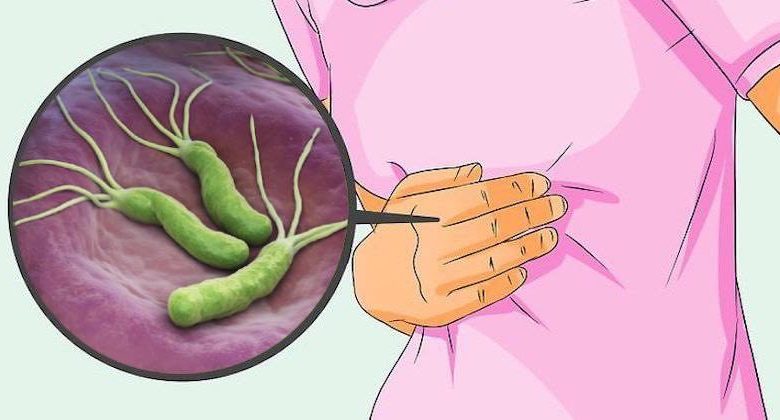 dieta per eliminare helicobacter pylori