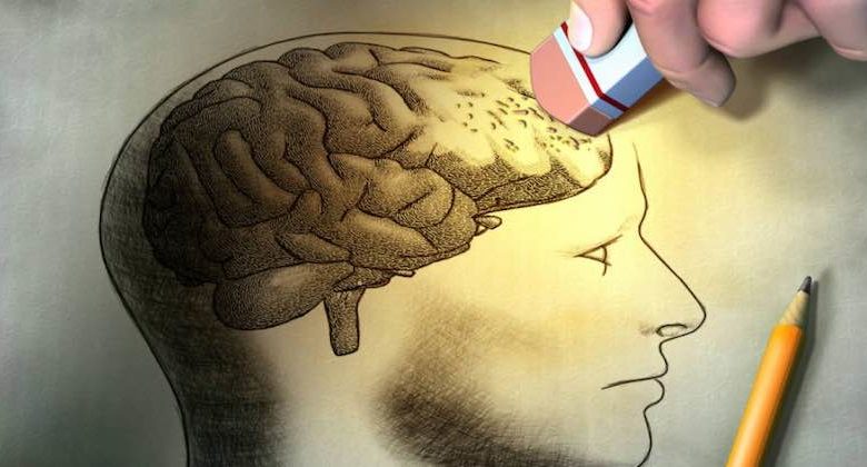 invertire l'Alzheimer