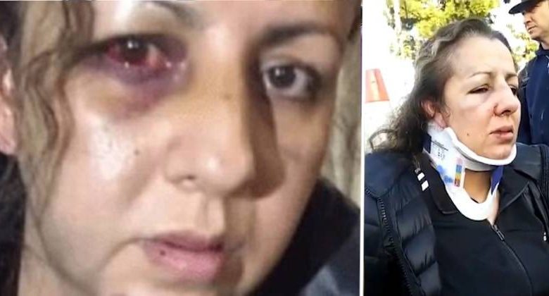 madre picchiata dalle bulle della figlia