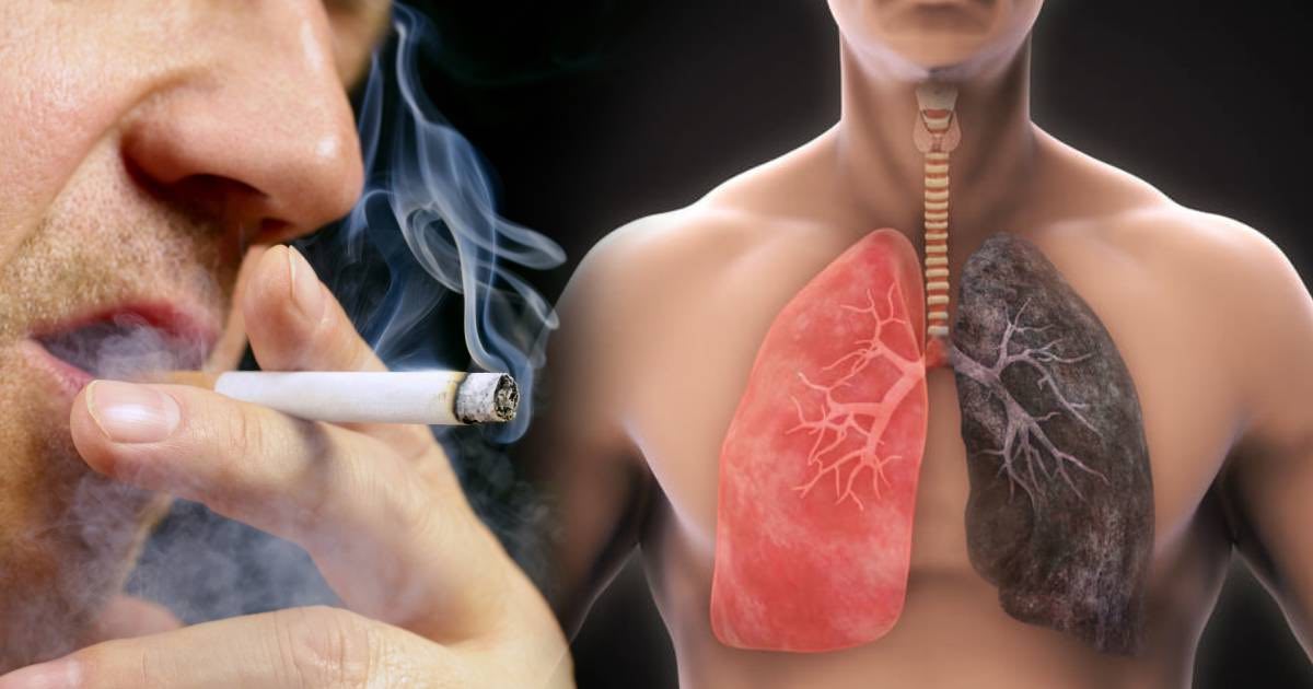polmoni possono rigenerarsi se si smette di fumare