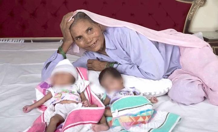 Una donna di 74 anni dà alla luce due gemelli