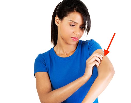 La piccola cicatrice sul braccio- segno del vaccino contro il vaiolo